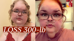 Tammy Slaton Loss 300-LB weight